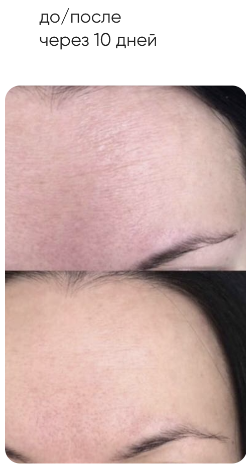 Smartcosmet - Крем для лица «Blue lifting cream» серии «Фотоомоложение», 50 мл