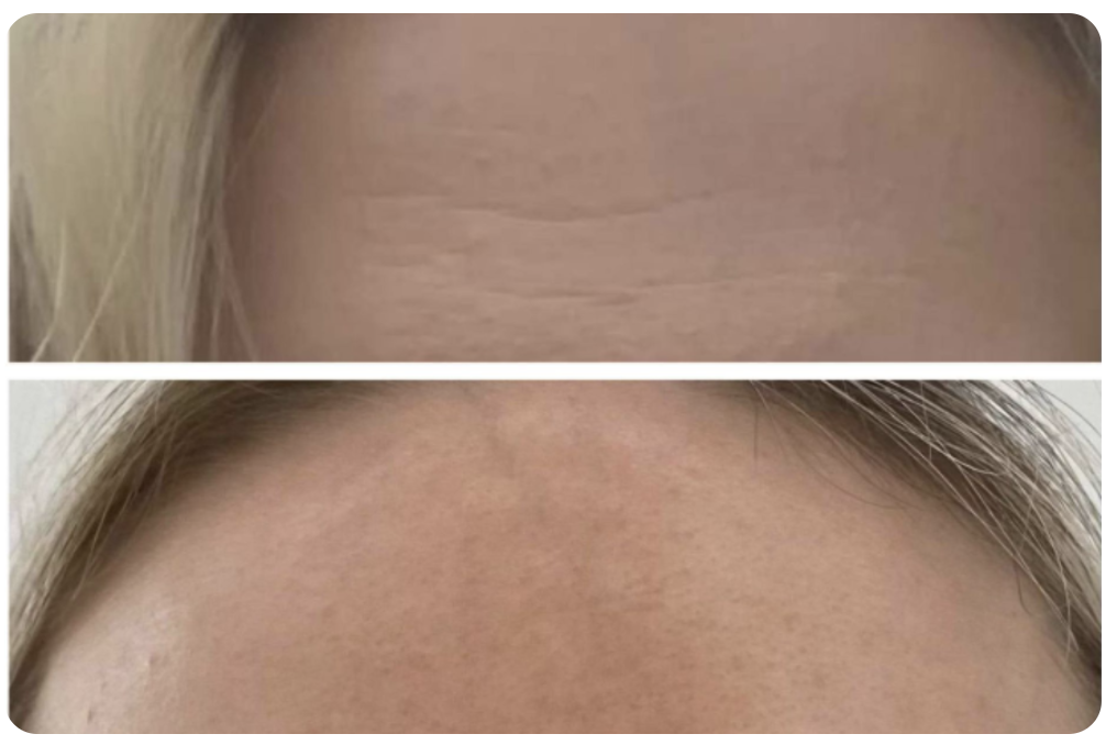 Smartcosmet - Гиалуроновый тоник-активатор, 150 мл