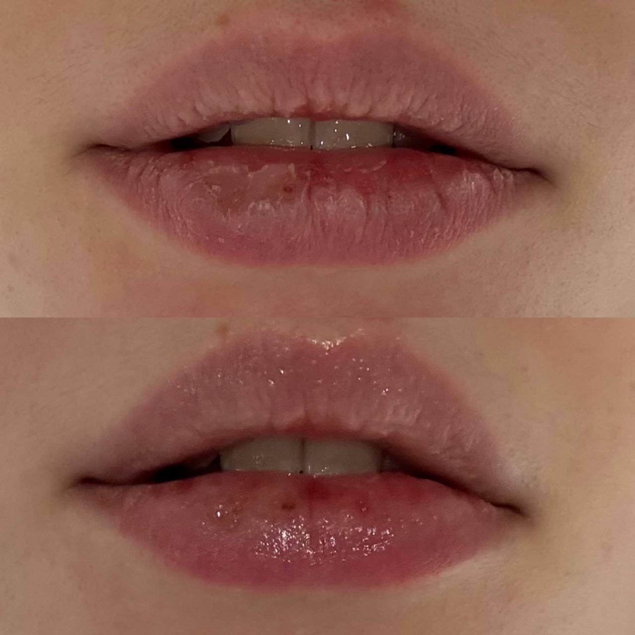 Smartcosmet - Squalane lip balm - Бальзам для губ